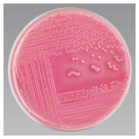 Thermo Scientific MacConkey Agar Medium:Microbiological Media and Media ...