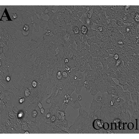 Hct 116 Cell Images Were Taken Under An Inverted Phase Contrast Download Scientific Diagram