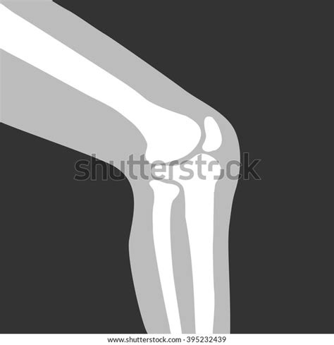 Human Knee Joint Side View Vector Stock Vector Royalty Free 395232439