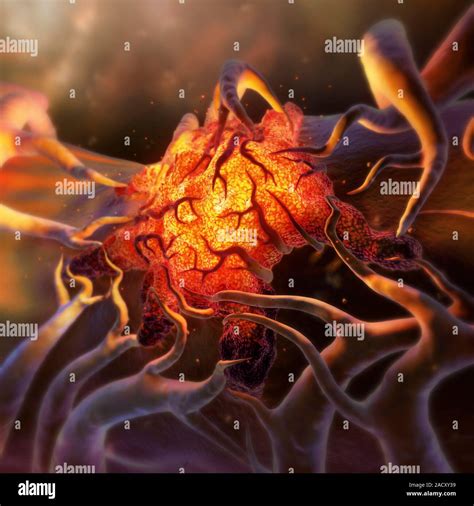 tumour conceptual artwork   glowing malignant cancerous tumour