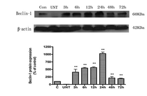 Beclin 1 Protein Expression In U251 Cells Western Blot Analysis Of