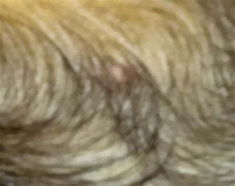 What Is That Black Mole On My Dogs Leg Pethelpful