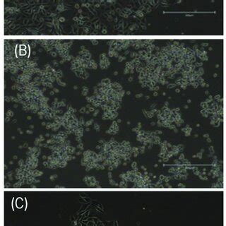 morphology   cell lines  study  ags cells
