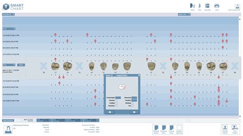 Voice Activated Perio Charting A Visual Reference Of Charts Chart Master