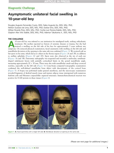 Pdf Asymptomatic Unilateral Facial Swelling In Year Old Boy