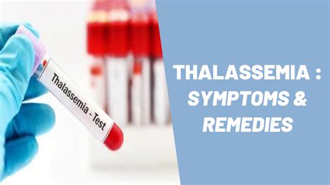 Thalassemia Signs And Symptoms