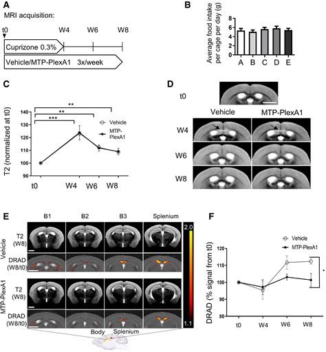 Disruption Of Sema3aplexin‐a1 Inhibitory Signalling In