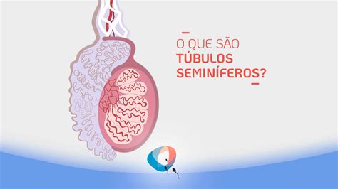 O Que S O T Bulos Semin Feros Dr Augusto Bussab Reprodu O Humana