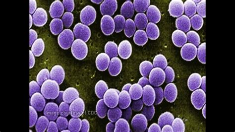 Staphylococcus Aureus Staphylococcus Aureus