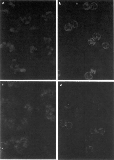 Patterns Of Indirect Immunofluorescence A Typical Perinuclear