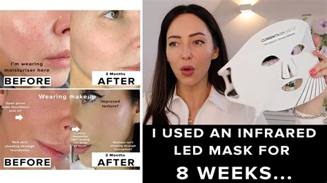 Led Light Therapy Mask Review | Shelly Lighting