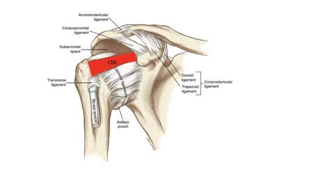 ACROMIOCLAVICULAR JOINT INJURY | PPT