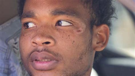 21-Year-Old Texas Man Who Was Brutally Beaten During Arrest Speaks