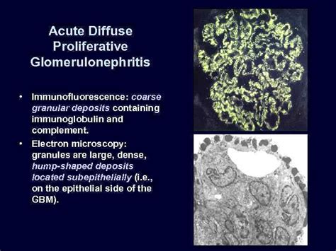 Renal Pathology Greg Balko Md May 27