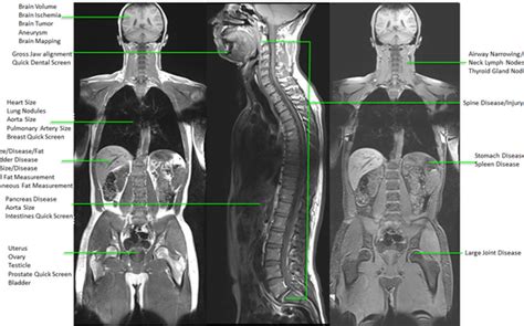 Whole Body Mri Wellness Screening By Ugorji Radiology Consultants In