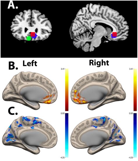 Ventromedial Prefrontal Cortex Seed Functional Connectivity