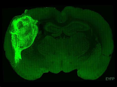 Unos Científicos Trasplantan Células Cerebrales Humanas En Cerebros De Ratones Un Avance En La