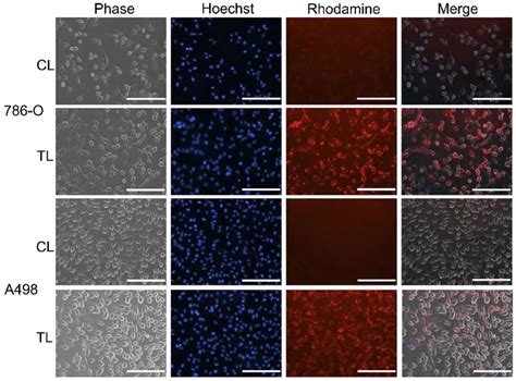 In Vitro Cellular Uptake Of Rhodamine PE Labeled Liposomes In RCC Cell