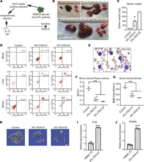 Jci Insight Htlv Viral Oncogene Hbz Drives Bone Destruction In