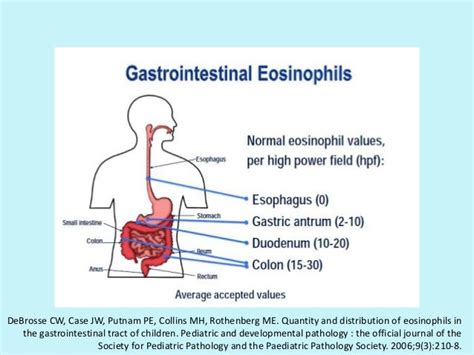 Eosinophilic Gastrointestinal Disorders Part I