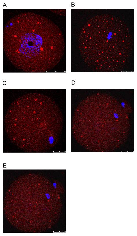 Dynamic Expression Of Epac And Rap In Mouse Oocytes And