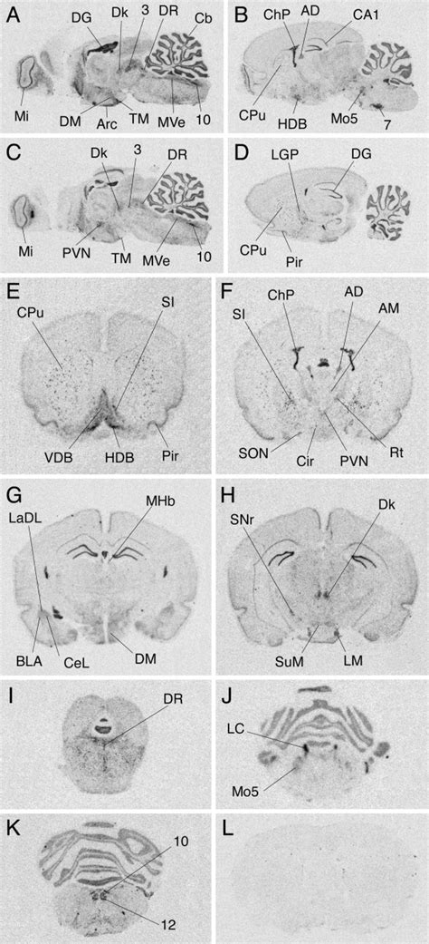 Neurochemical Characterization Of Pathways Expressing Plasma Membrane