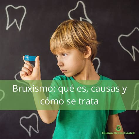 Bruxismo Qu Es Causas Y C Mo Se Trata Cl Nica Castell