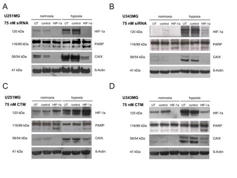 Effects of HIF 1α siRNA and CTM in U251MG and U343MG Cells Western