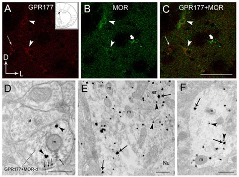 Mor And Gpr Colocalize Within Mouse Striatum Region Of The Striatum