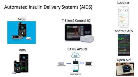 Automated Insulin Delivery Systems Aids The Glucose Never Lies