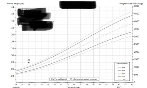 Fundal Height Measurement Chart