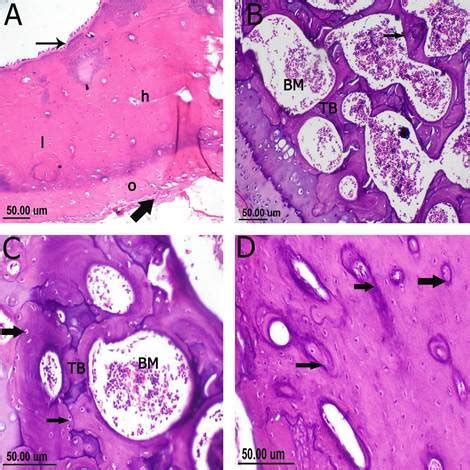 Estudio Histopatol Gico E Inmunohistoqu Mico De La Eficacia