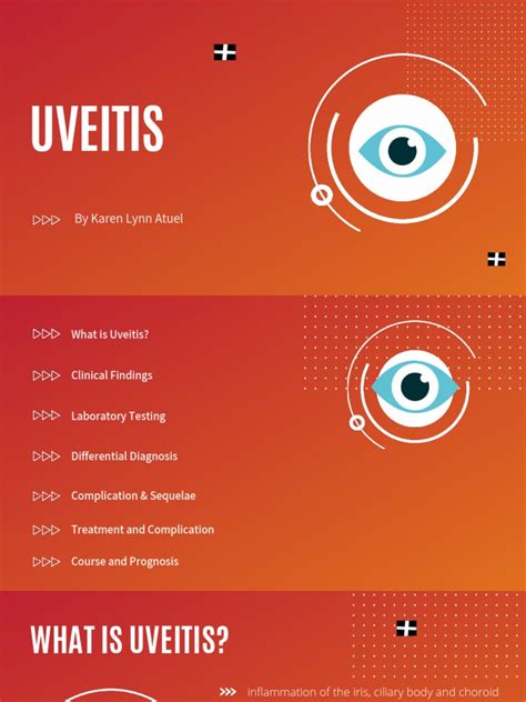 A Comprehensive Review Of Uveitis Etiology Clinical Presentation