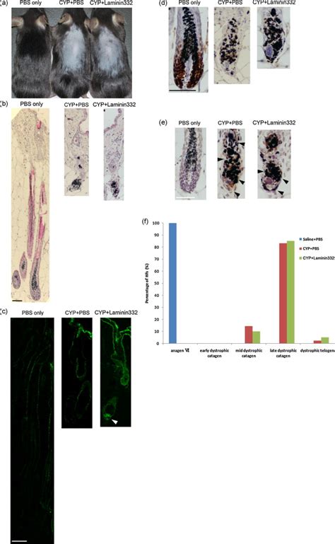 Laminin Inducer Of Hair Growth Is Down Regulated And Its