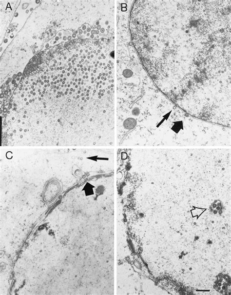 Tem Of Hsv 1 Infected Vero Cells Vero Cells Were Infected With Kos Download Scientific Diagram