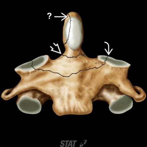 MSK Radiology Lecture Flashcards Quizlet