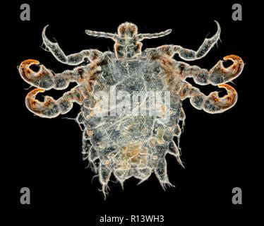 Human Crab Louse Pediculus Pubis Photomicrograph Stock Photo Alamy