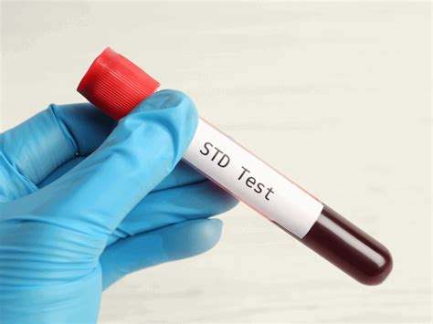 Why Early Stistd Testing Is Crucial Modern Urgent Care