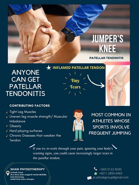 Shaik Physio - What are the symptoms of jumper's knee? Following are