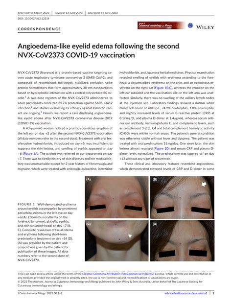 Pdf Angioedema‐like Eyelid Edema Following The Second Nvx‐cov2373