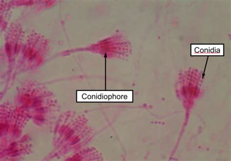 Lab 3 Yeasts And Protistans Flashcards Quizlet