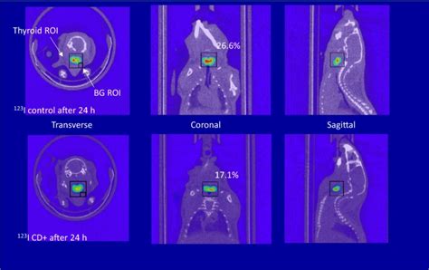 Reduction of thyroid radioactive iodine exposure by oral administration ...