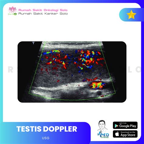 Usg Testis Doppler