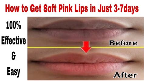 How To Get Soft Pink Lips Naturally At Home In Just 3 7 Days Turn