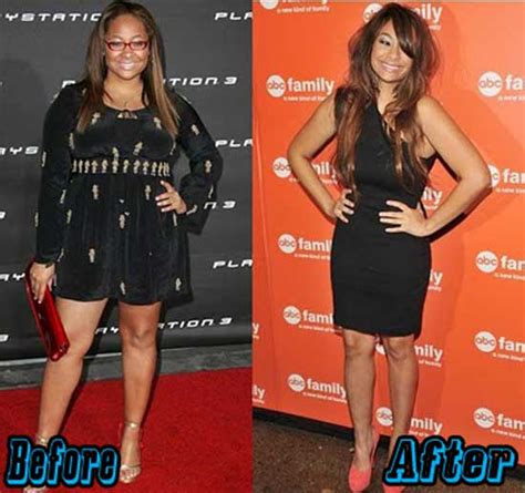 Raven Symone Plastic Surgery: Facts or Rumors