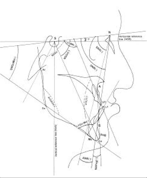 Reference Points And Lines For Hard Tissue Angular Measurements Download Scientific Diagram