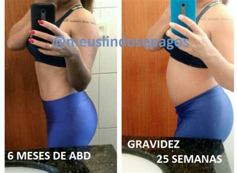 Meus Lindos e Pagos Arquivos Gravidez após a abdominoplastia