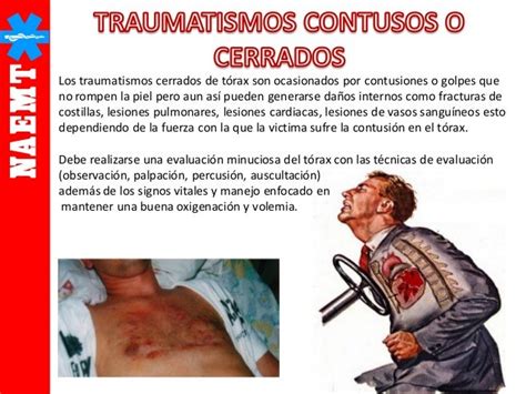 Trauma De Torax Psf