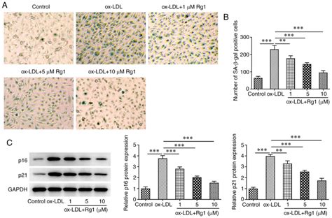 Ginsenoside Rg1 Ameliorates Apoptosis Senescence And Oxidative Stress