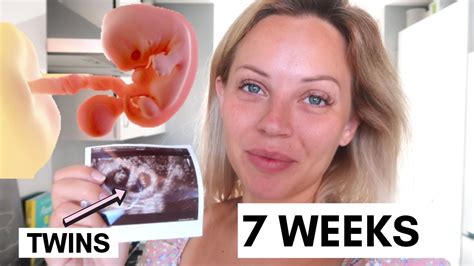 7 Weeks Pregnant With Twins 7 Week Pregnancy Update Lucy Jessica